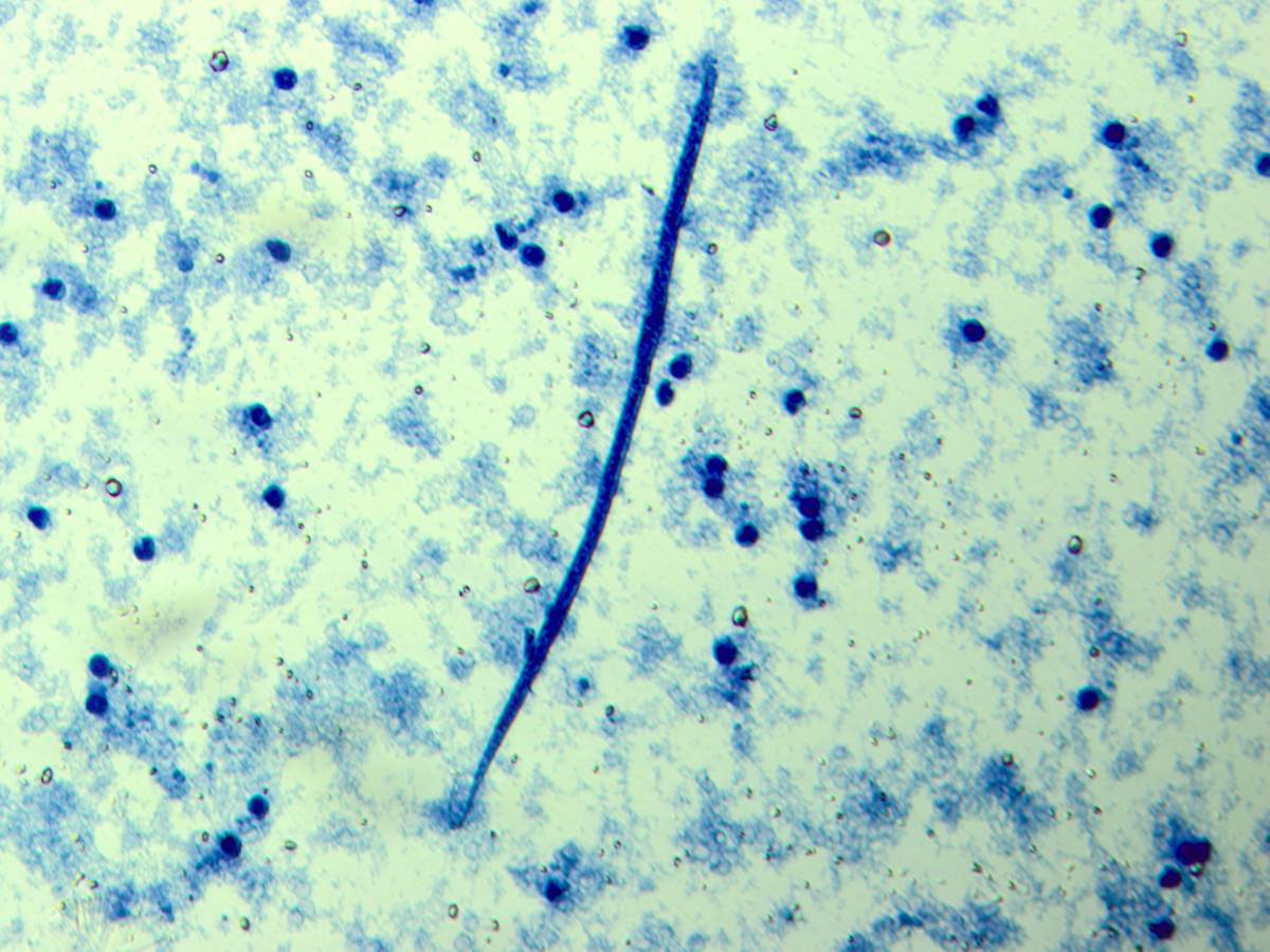 4th OHD Training school - Cell culture as in vitro models for newly developed drugs against vector borne parasitic diseases within the One Health concept
